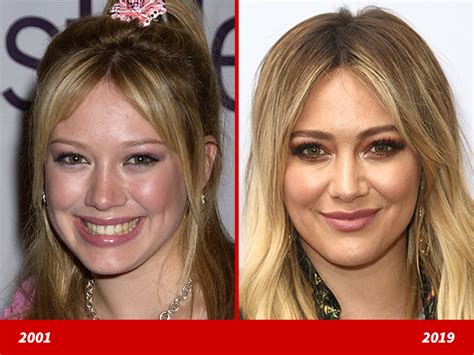 hillary duff nose job|How A